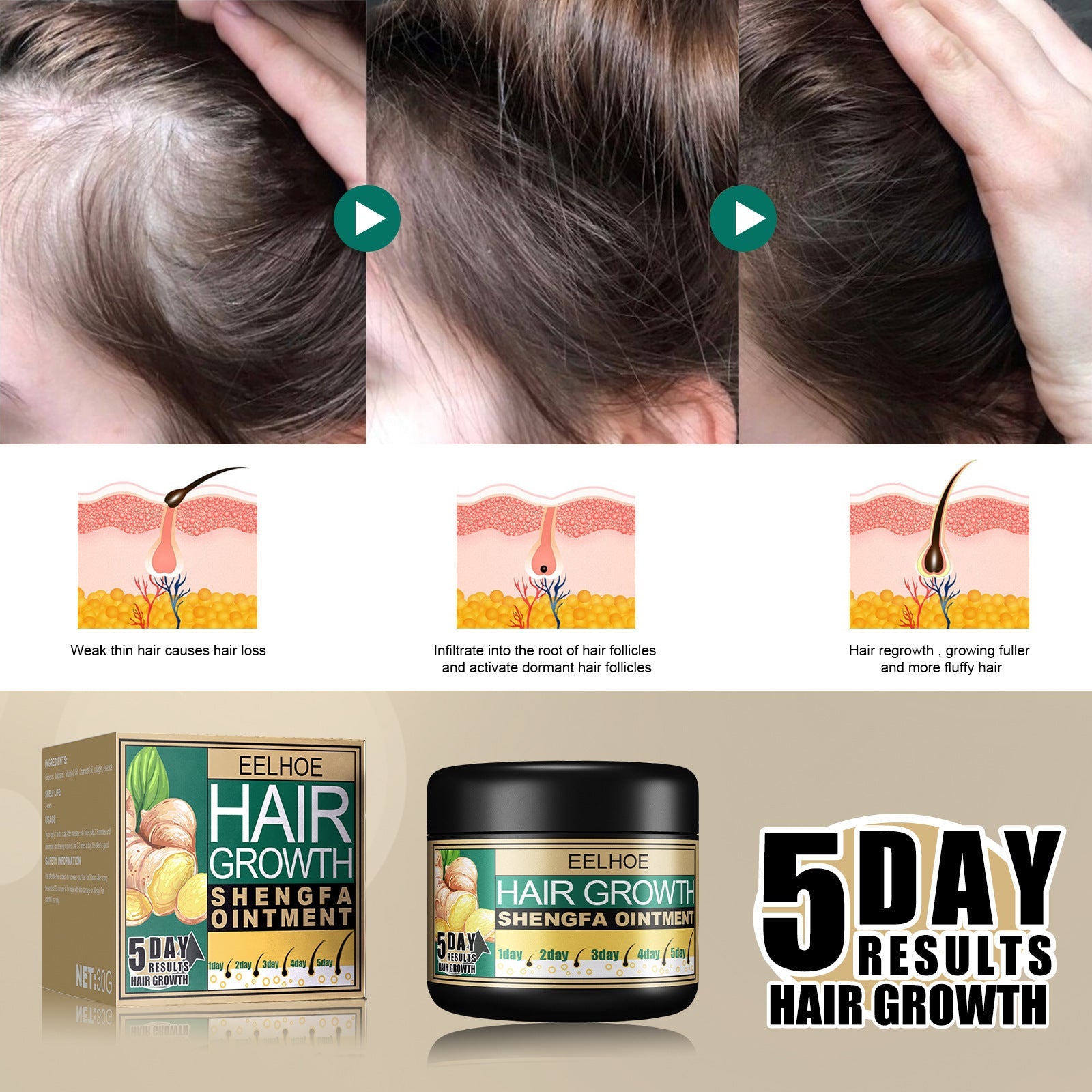 Hair Regrowth Ginger Extract Cream